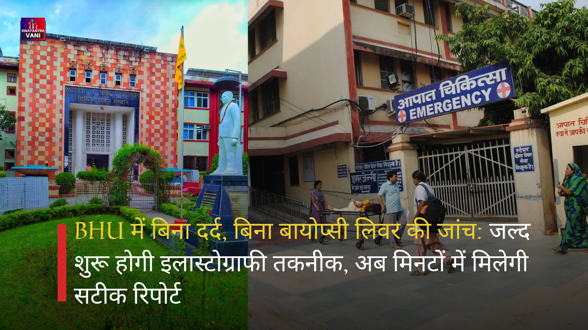 BHU में बिना दर्द, बिना बायोप्सी लिवर की जांच: जल्द शुरू होगी इलास्टोग्राफी तकनीक