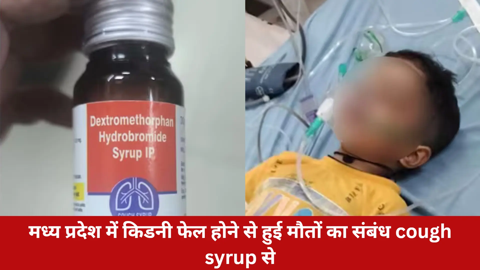 मध्य प्रदेश में किडनी फेल होने से हुई मौतों का संबंध cough syrup से