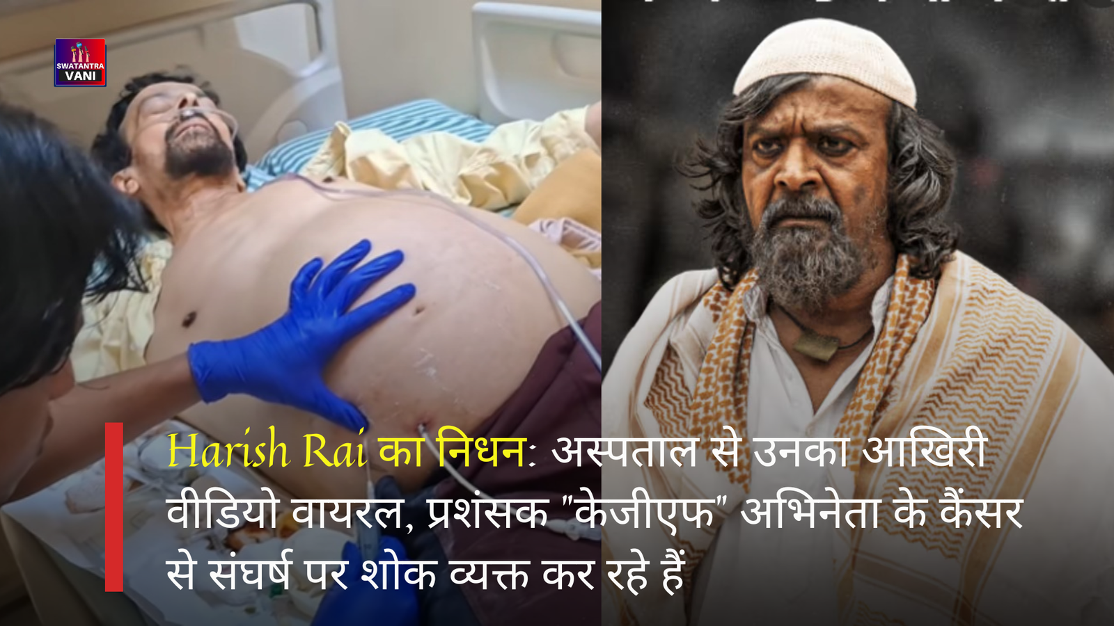 Harish Rai का निधन: अस्पताल से उनका आखिरी वीडियो वायरल, प्रशंसक "केजीएफ" अभिनेता के कैंसर से संघर्ष पर शोक व्यक्त कर रहे हैं